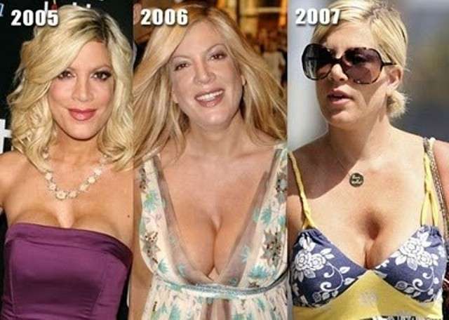 Tori Spelling