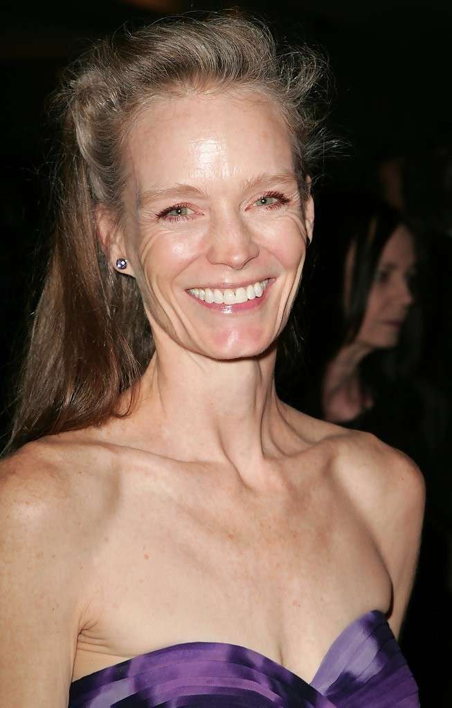 Suzy Amis