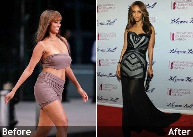 Tyra Banks