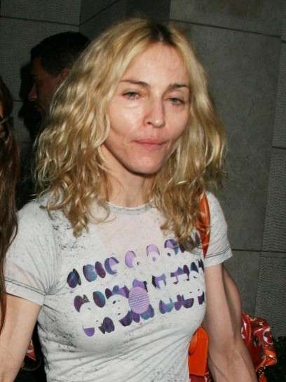 Madonna emaciata