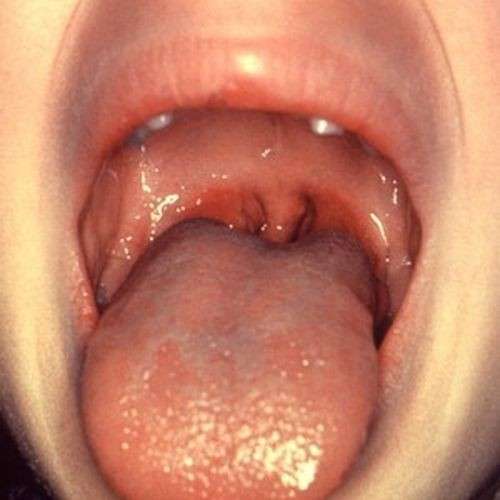La mucosa della bocca
