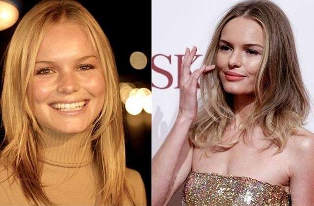 Kate Bosworth