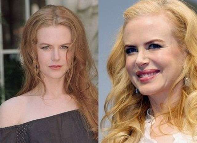 Nicole Kidman