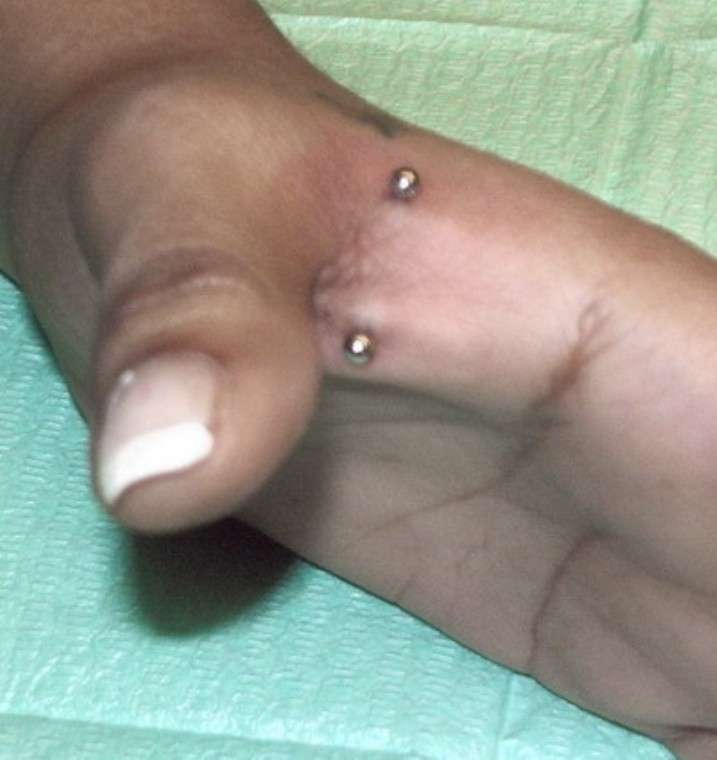 Piercing sulle mani