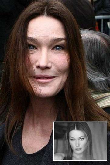 Carla Bruni prima e dopo