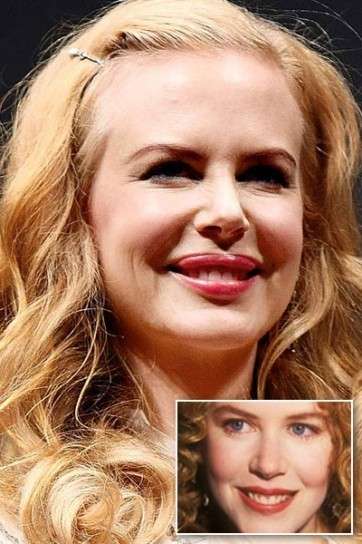 Nicole Kidman prima e dopo
