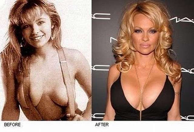 Pamela Anderson