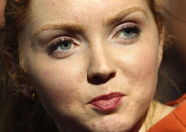 Lily Cole con acne