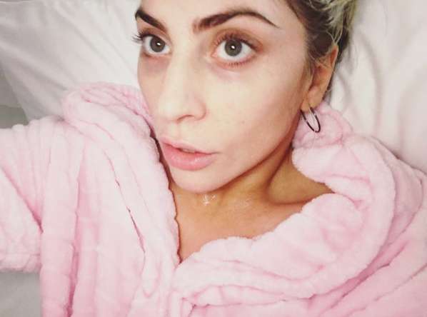Lady Gaga senza trucco