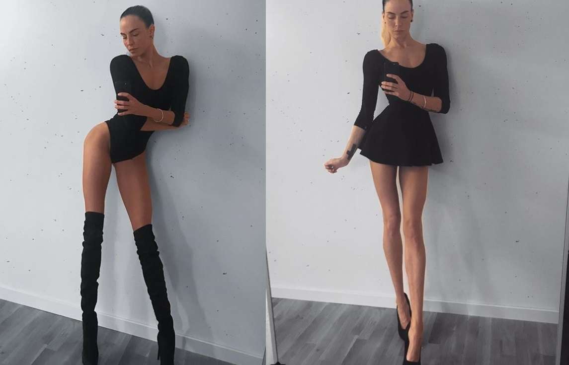 Ia Ostergren, la modella svedese dalla gambe lunghissime vittima di bullismo