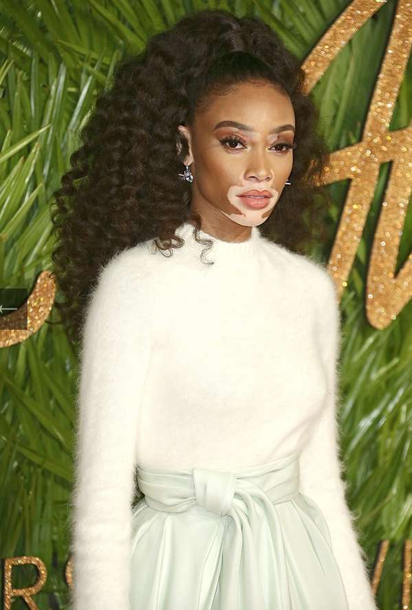 Winnie Harlow